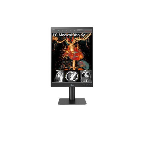 LG 21HQ513D 21.3” 3MP IPS Diagnostic Monitor