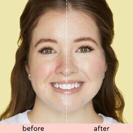 Buy Tarte Skin Treat Poreless Tinted Moisturizer Broad Spectrum Spf 20 Online Worldwide Tejar Com